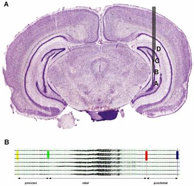 Ictal Occurrence of High-Frequency Oscillations Correlates With Seizure Severity in a Rat Model of Temporal Lobe Epilepsy